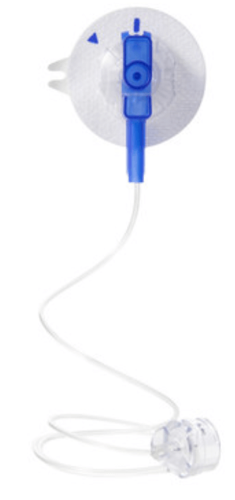 優(yōu)泵儲(chǔ)藥器導(dǎo)管套裝 優(yōu)泵儲(chǔ)藥器導(dǎo)管套裝